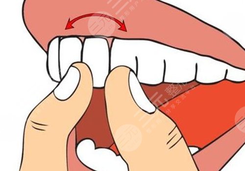 牙齒松動有什么辦法恢復?