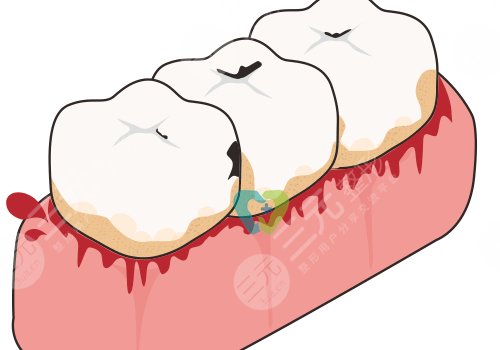 牙齒松動有什么辦法恢復?
