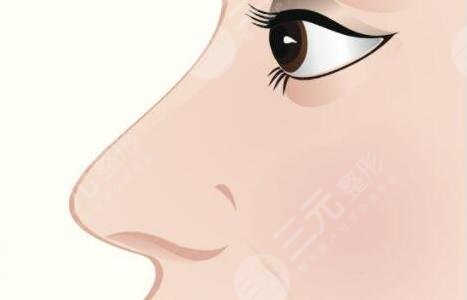 鼻子整形可以維持一輩子嗎？10年、20年后怎么辦？鼻科醫(yī)生告訴你實(shí)情！