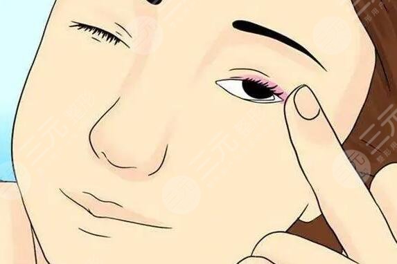 眼部脂肪粒如何去除小妙招，這4種強(qiáng)有力的手段讓你擺脫“小米?！蓖纯?！
