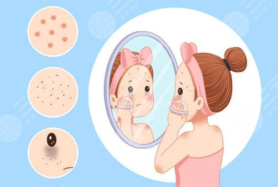 斑點(diǎn)是怎樣形成的?