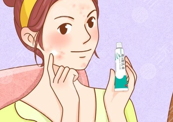 去除老年斑的方法有哪些