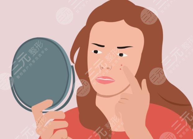 緩解青春痘價(jià)格