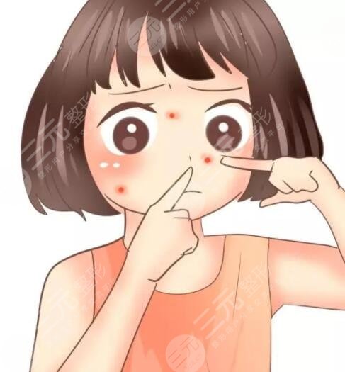 緩解青春痘價(jià)格