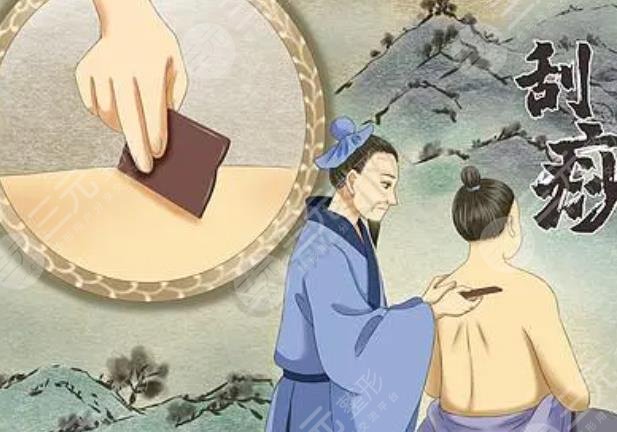 刮痧