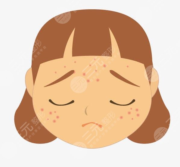 如何快速去除痤瘡見效快?