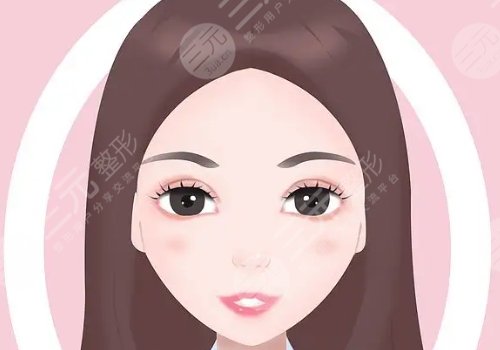 蘋果肌太大怎么改良？