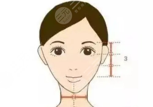 蘋果肌太大怎么改良？