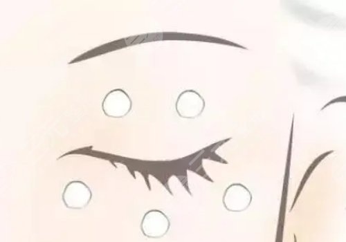 眼周圍有脂肪粒怎么引起的？