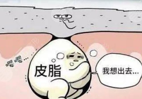 眼周圍有脂肪粒怎么引起的？