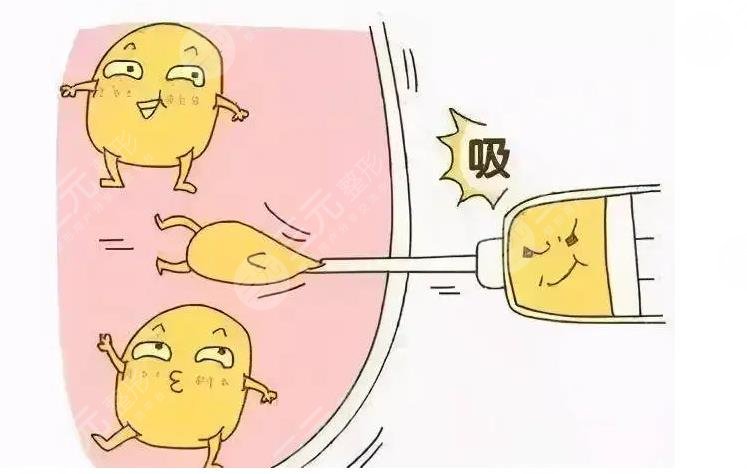 鼻翼寬大怎么辦?