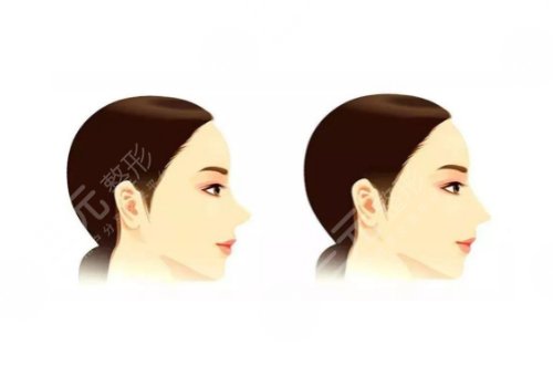 重慶華美做鼻子哪個醫(yī)生好?