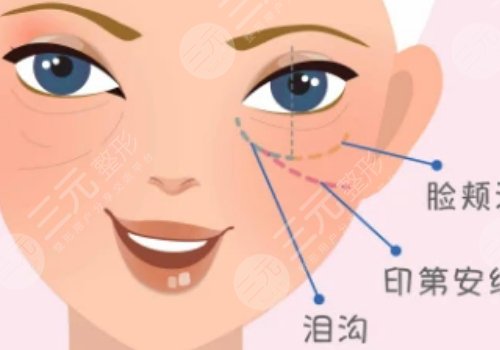 重慶華美做眼袋手術好的醫(yī)生