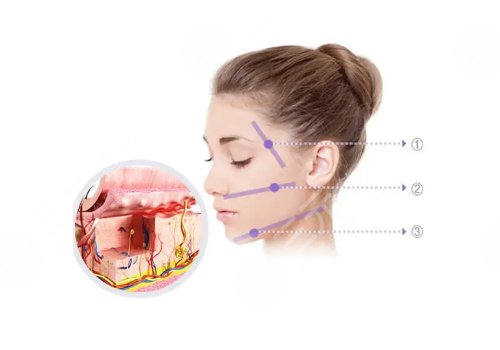 湘雅醫(yī)院整形科價目表
