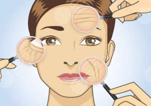 如何去除抬頭紋？