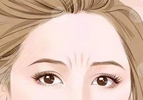 如何去除抬頭紋？