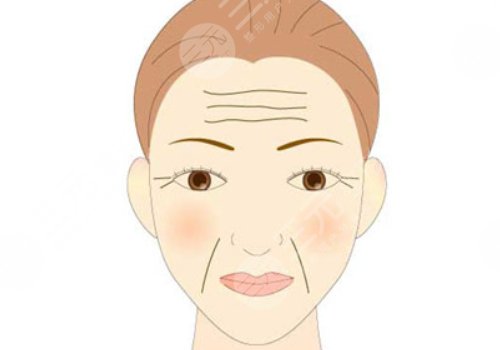 如何去除抬頭紋？