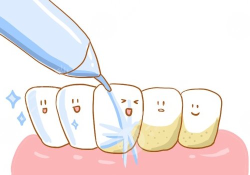 洗牙的危害與好處有哪些？