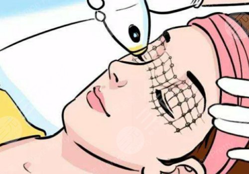 黃金熱拉提的功效與作用