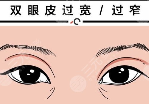 雙眼皮修復(fù)大概多少錢呢?