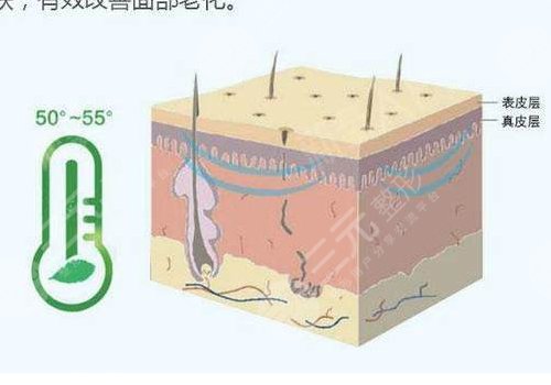 深藍射頻做一次有效果嗎？