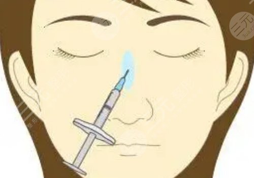 愛(ài)貝芙隆鼻會(huì)變寬嗎