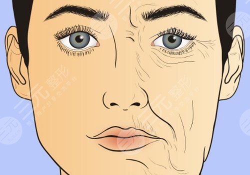 深藍(lán)射頻和熱拉提哪個(gè)好？