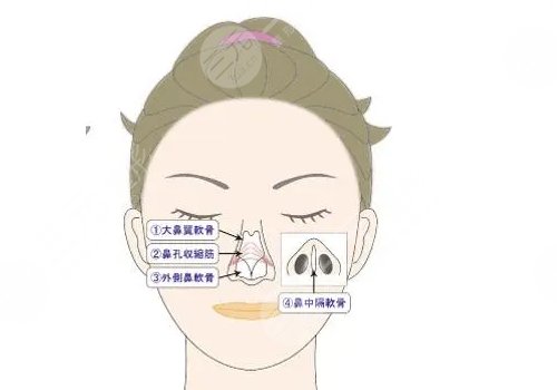 鼻小柱抬高是怎么做的？