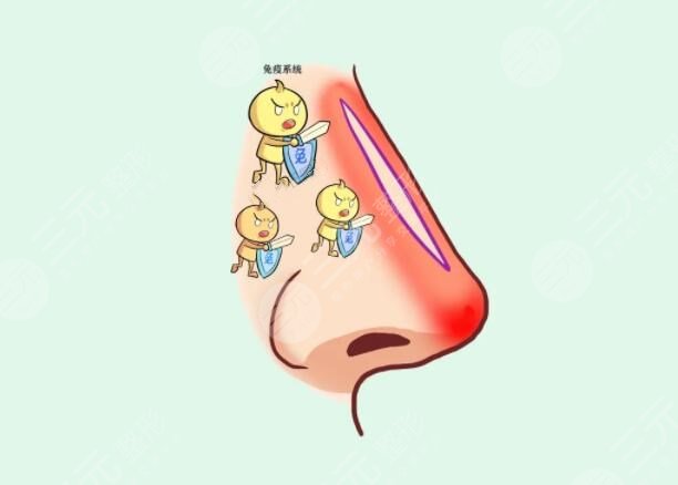 隆鼻整形手術(shù)