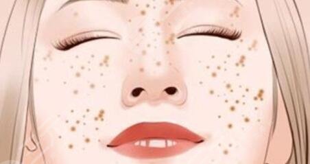 關(guān)于祛斑的方法有哪些是正確的？有效方法大全、看看哪種是你的菜~