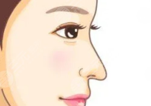 膠原蛋白隆鼻會(huì)變寬嗎？