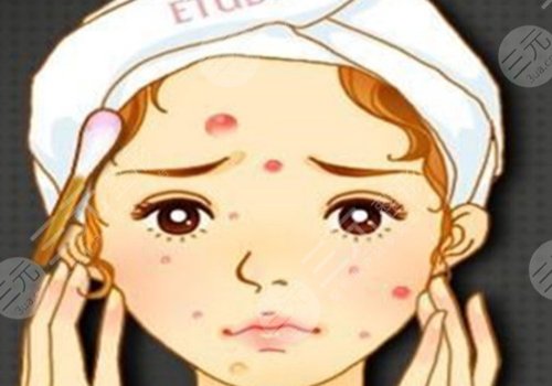 祛痘印痘坑好的方法