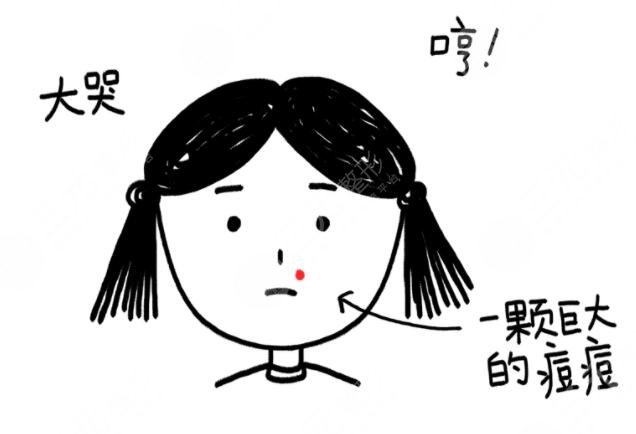 激光緩解痤瘡應(yīng)該注意哪些問題?