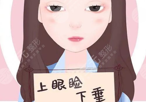 上瞼下垂矯正大概需要多少費用？