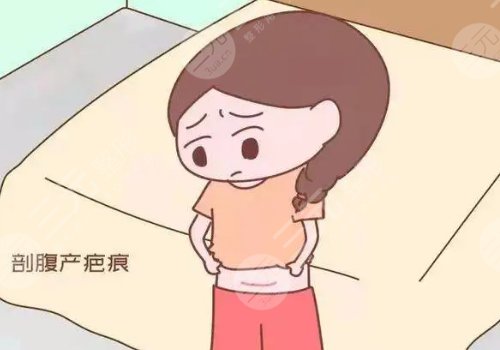 激光去疤痕需要幾次才能徹底消除？