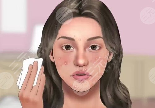 去黑頭收縮毛孔好的方法有哪些？