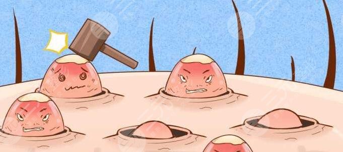 激光祛痘疤注意事項(xiàng)有哪些?