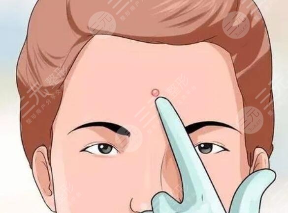 青春痘緩解價格多少錢一般？醫(yī)院規(guī)格、醫(yī)生實力、痘痘嚴重程度都在影響價格！