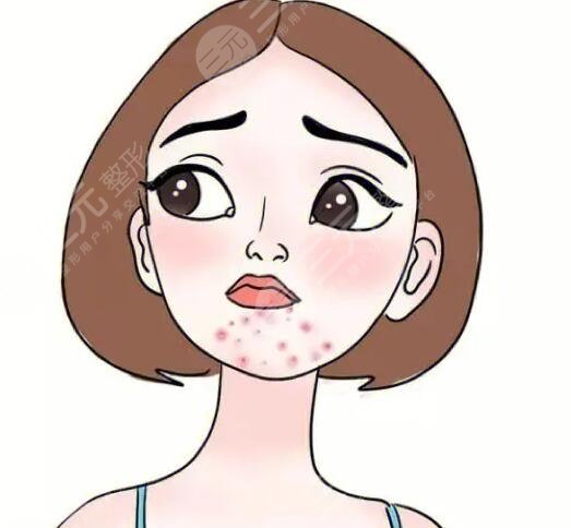 　　很多人經(jīng)常在下巴處會(huì)長(zhǎng)一些痘痘，有的人認(rèn)為長(zhǎng)痘痘的原因是和自己的內(nèi)分泌有關(guān)系，也有的女性朋友認(rèn)為自己的長(zhǎng)痘問(wèn)題和自己的護(hù)膚存在一定的關(guān)系，所以說(shuō)在面對(duì)自己的痘痘時(shí)，一定要充分地了解自己長(zhǎng)痘的類型，這樣才能夠改良痘痘使痘痘消除，所以說(shuō)想豆豆和我們的身體健康存在一定關(guān)系的，大家不但要調(diào)整自己的作息習(xí)慣，同時(shí)也要有正確的護(hù)膚流程，一起來(lái)了解下吧，長(zhǎng)痘的是哪里的問(wèn)題?  　　下巴長(zhǎng)痘痘是哪里的問(wèn)題?  　　1、飲食問(wèn)題  　　下巴長(zhǎng)痘痘根據(jù)飲食有著一定的關(guān)系，所以說(shuō)如果我們長(zhǎng)期飲食不規(guī)律，在體內(nèi)的毒素長(zhǎng)期積累，從而會(huì)影響我們的皮膚狀態(tài)產(chǎn)生一些皮膚問(wèn)題，例如長(zhǎng)痘痘長(zhǎng)色斑等，建議大家在飲食方面堅(jiān)持以清淡健康的飲食為主，也要少吃一些辛辣刺激性的食物，這樣才可以很好地改良肌膚，也要養(yǎng)成良好的作息習(xí)慣，可以早睡早起經(jīng)常參加一些鍛煉，也能夠減少痘痘的產(chǎn)生，同時(shí)也要戒煙戒酒，把這些壞習(xí)慣都改掉之后，配合飲食配合作息，就可以改良痘痘。  　　2、激素失衡問(wèn)題  　　有一些人群下巴長(zhǎng)痘痘的原因和自己體內(nèi)激素分泌有一定的關(guān)系，所以說(shuō)如果激素失衡，也會(huì)在下巴處長(zhǎng)一些痘痘，比如說(shuō)女性朋友在來(lái)月經(jīng)之前，身體內(nèi)的激素會(huì)處于一個(gè)不平衡的狀態(tài)，會(huì)間接引起皮脂腺分泌旺盛，從而在下巴處長(zhǎng)出一些痘痘，如果是這種情況，建議大家一定要放松心情，從而改良睡眠質(zhì)量，減輕壓力，才可以很好地度過(guò)這個(gè)時(shí)期，但是這種痘痘往往在月經(jīng)過(guò)后就會(huì)恢復(fù)到一個(gè)正常的皮膚狀態(tài)，不用過(guò)分的擔(dān)心。  　　3、內(nèi)分泌失調(diào)  　　內(nèi)分泌失調(diào)也會(huì)導(dǎo)致痘痘的產(chǎn)生，所以說(shuō)在失調(diào)的過(guò)程當(dāng)中會(huì)使皮脂腺分泌得過(guò)于旺盛，由于油脂分泌的較多，不能夠及時(shí)清潔，很容易堵塞毛孔，產(chǎn)生一些油膩的痘痘，這時(shí)候一定要調(diào)節(jié)自己的內(nèi)分泌，改良自己的睡眠，才可以改良痘痘，也可以服用一些中藥來(lái)進(jìn)行改良。  　　4、體內(nèi)毒素堆積過(guò)多  　　如果我們經(jīng)常吃一些比較油膩的食物，會(huì)引起消化方面的問(wèn)題，所以說(shuō)在體內(nèi)會(huì)堆積過(guò)多的毒素，從而使毒素沒(méi)有辦法排出，導(dǎo)致痘痘的產(chǎn)生，如果是體內(nèi)毒素堆積過(guò)多，首先長(zhǎng)痘的部位就是下巴處，這時(shí)候人們的肝臟排毒功能也逐漸下降，一定要積極地調(diào)整飲食，健康的作息才可以得到根本的改變，這時(shí)候可以吃一些比較常見(jiàn)的排毒養(yǎng)顏膠囊，也可以在專業(yè)的醫(yī)生指導(dǎo)下吃一些中藥。  　　5、青春痘  　　很多人在青春期的時(shí)候會(huì)長(zhǎng)一些痘痘，這么也是大家所說(shuō)的，青春痘在長(zhǎng)痘的過(guò)程當(dāng)中還會(huì)伴隨局部疼痛紅腫等問(wèn)題，一定要積極地尋找醫(yī)生的緩解，可以選用激光緩解痘痘。