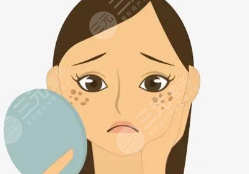 激光祛斑會(huì)不會(huì)反彈？需要做幾次？