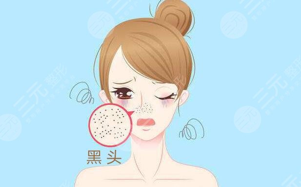 用油熔融油去除黑頭