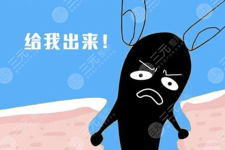 出現(xiàn)黑頭原因