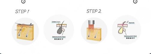 白瓷娃娃多少錢一次正常?