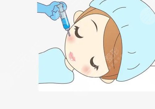 注射瘦臉會(huì)反彈嗎？