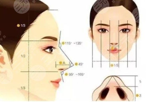 隆鼻假體取出來后能恢復(fù)到以前嗎？