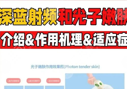 深藍(lán)射頻和光子嫩膚哪個(gè)好？