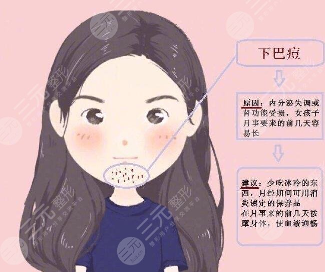 激光祛痘需要多長時間能徹底恢復(fù)好？需要緩解幾次？療程是多久？