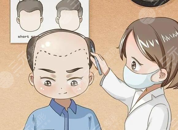 脫發(fā)護(hù)理注意事項(xiàng)