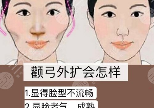 杭州時(shí)光陳小平顴骨下顎骨技術(shù)怎么樣？