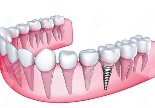 成都畫(huà)美團(tuán)圓口腔醫(yī)院醫(yī)生介紹